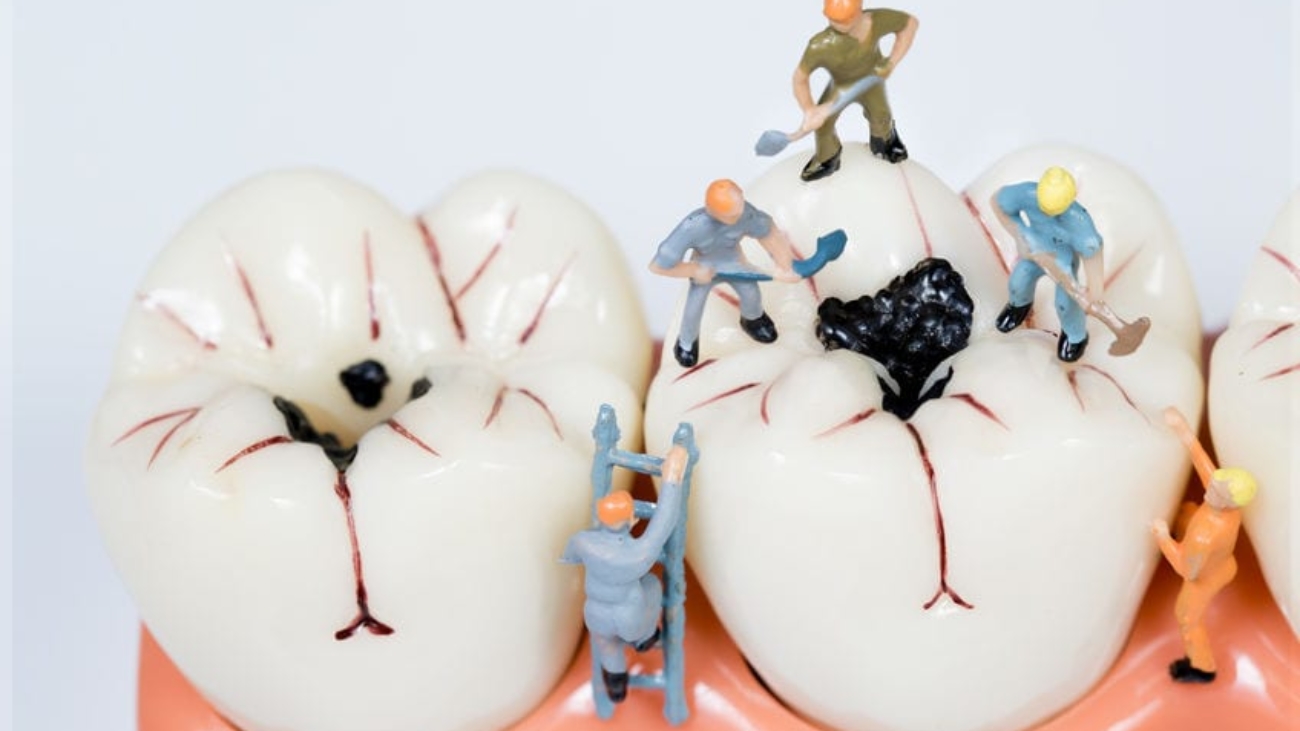 miniature people clean tooth model,medical concept