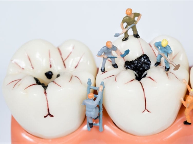 miniature people clean tooth model,medical concept